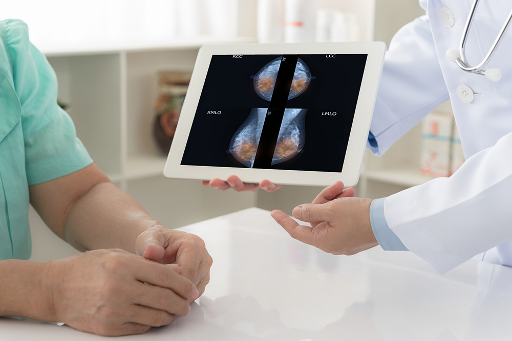 Ein Arzt zeigt einer Patientin den Scan einer Mammografie. 